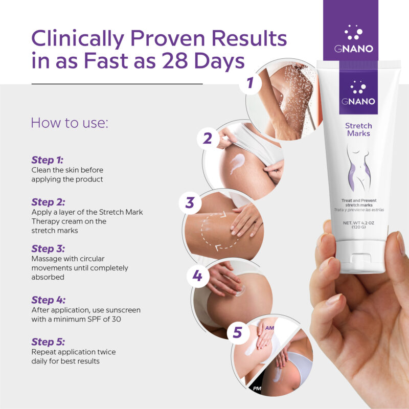 GNANO ADVANCED STREACH MARK THERAPY CREAM - Image 3