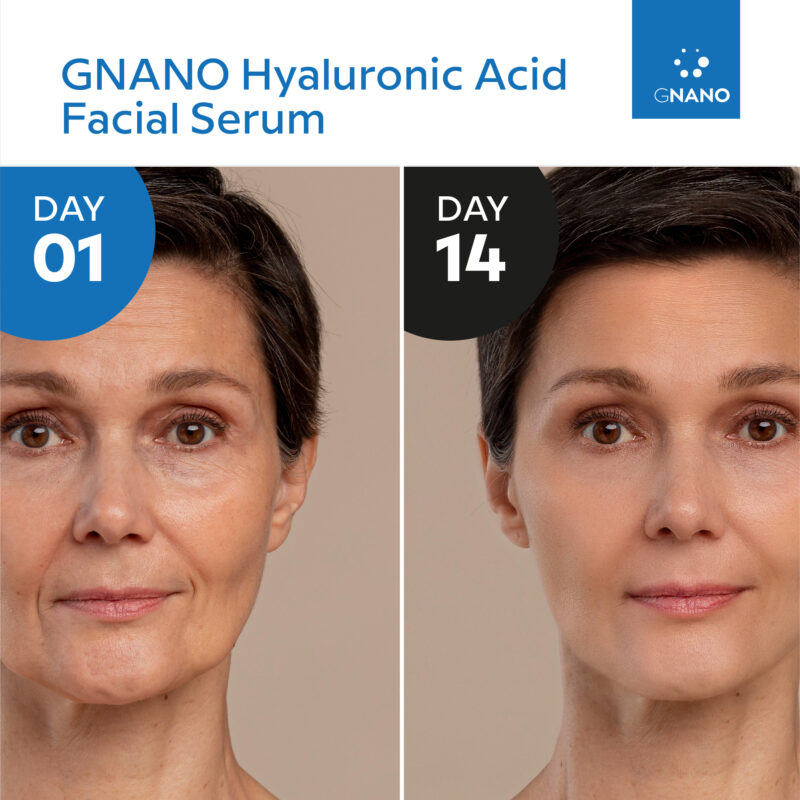 GNANO 100% HYALURONIC ACID - Image 7